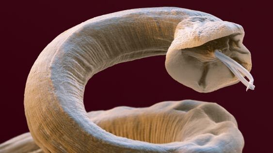 Parasite inside a person