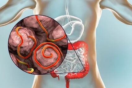 Parasites in the intestine