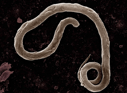 Where do worms in the human body come from