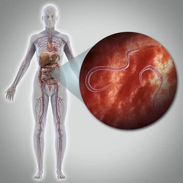 Parasites in a human body