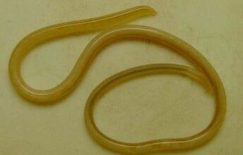 Types of parasites in humans