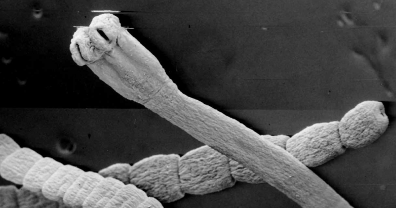 worms from human body