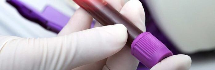 blood for parasite testing