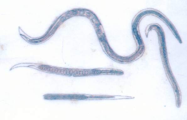Guinea worms live under the skin and are easily infected