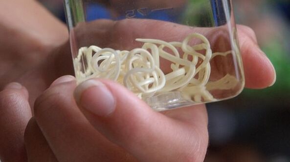 Heartworms look like a long thread